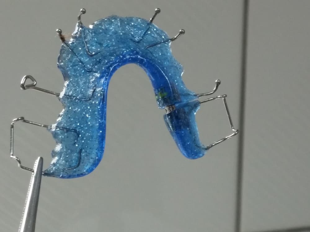 Arcos dentales como usar