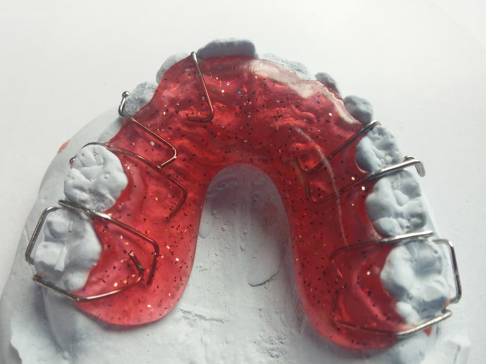 Arcos dentales como usar