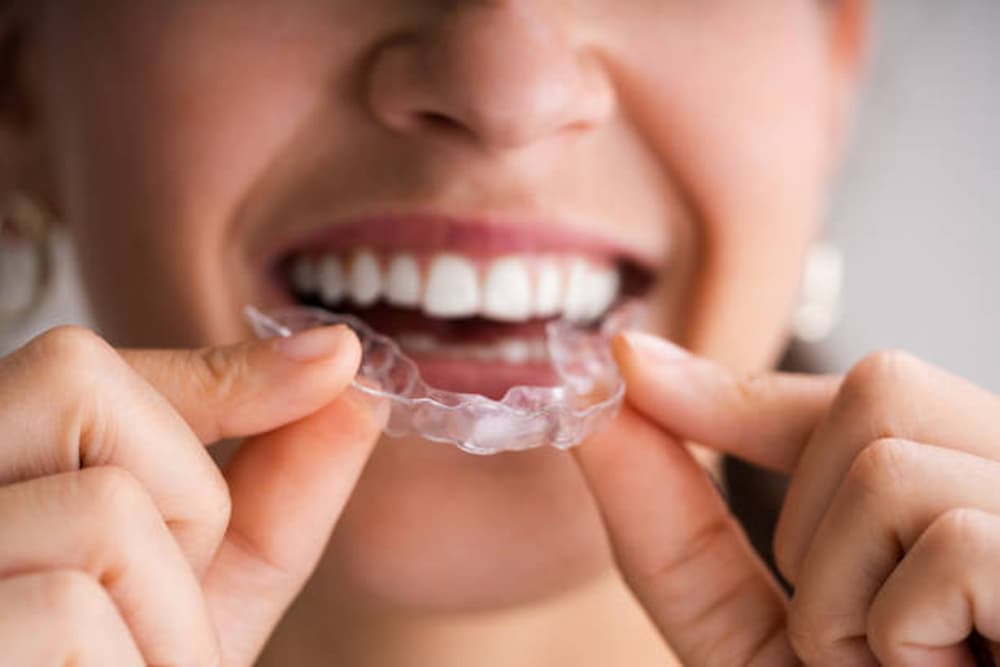 Como limpiar ferula dental