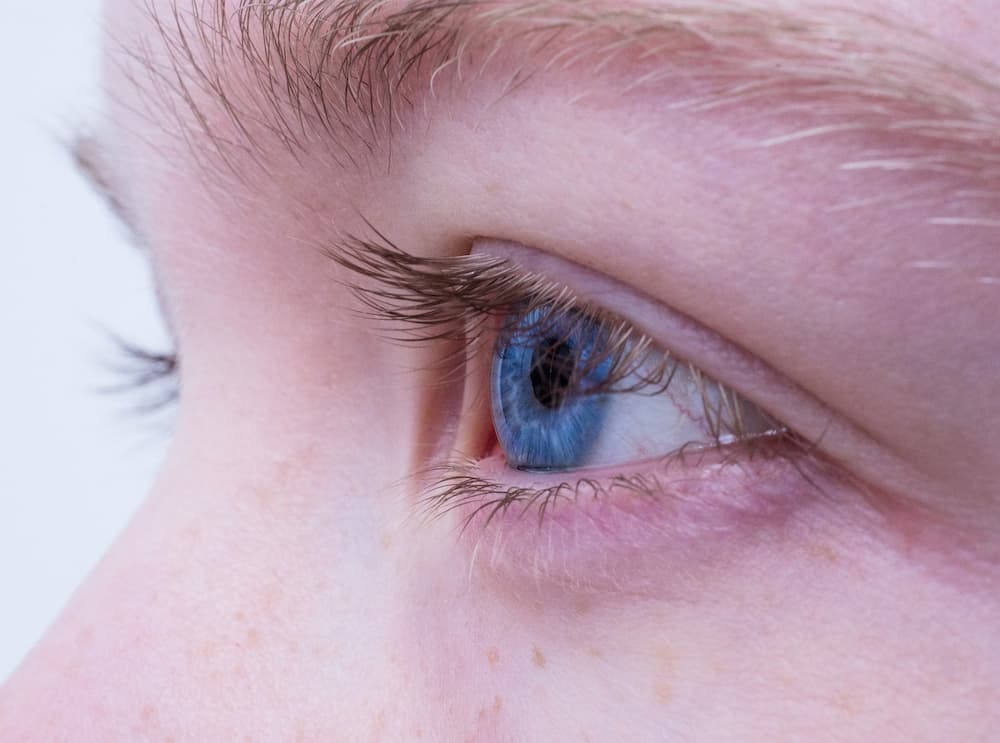Como quitar una verruga en el borde del ojo