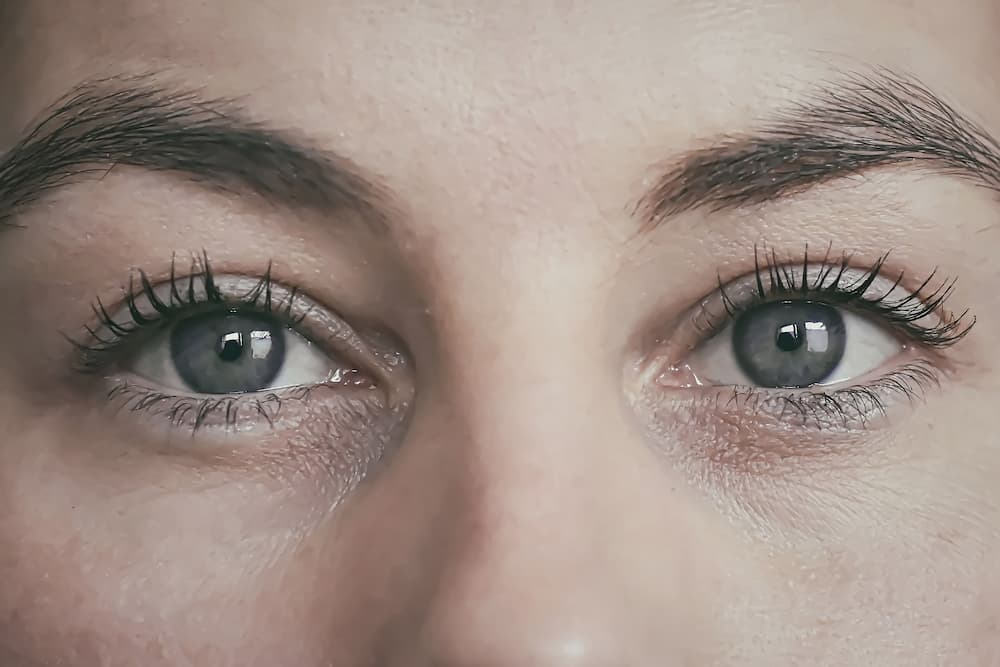 Como quitar ojeras y bolsas