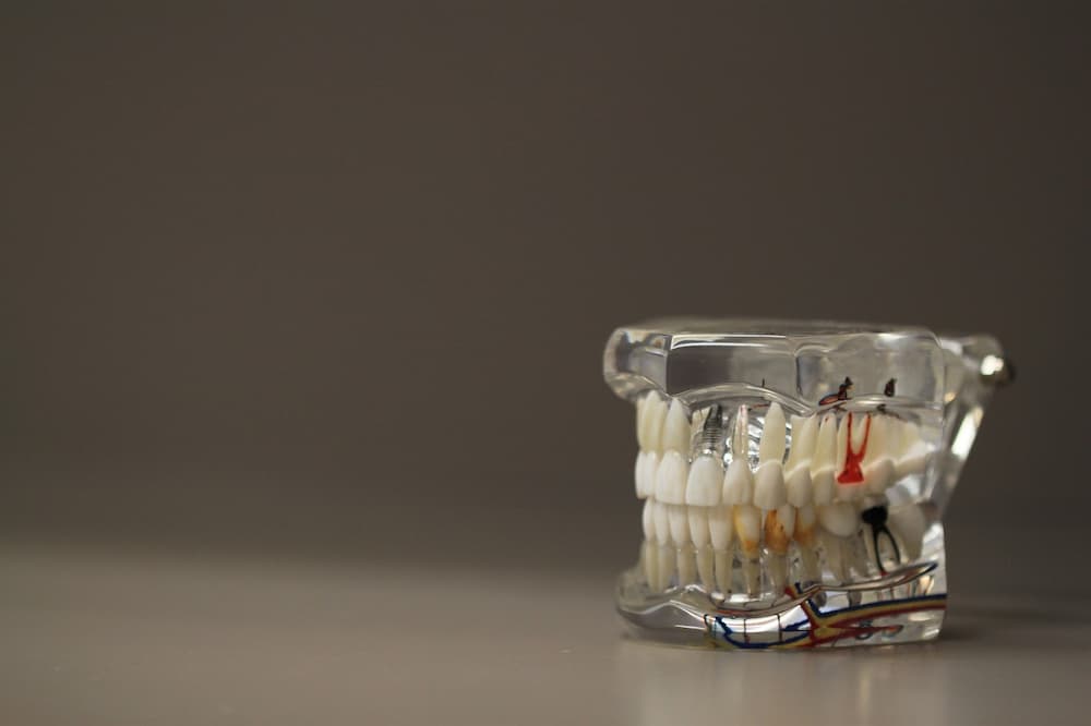 Como regenerar hueso dental naturalmente