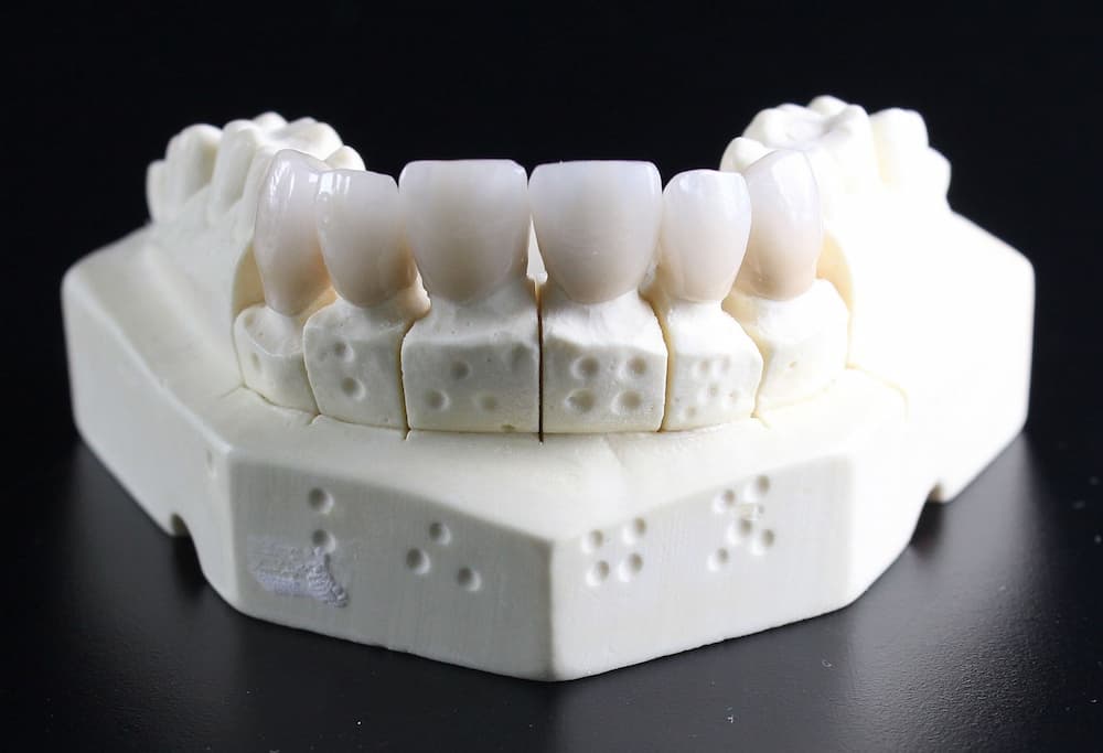 Como regenerar hueso dental naturalmente