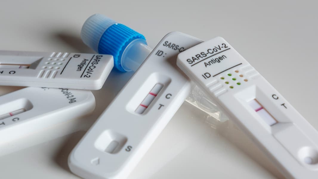 Diferencia entre test de antigenos y PCR